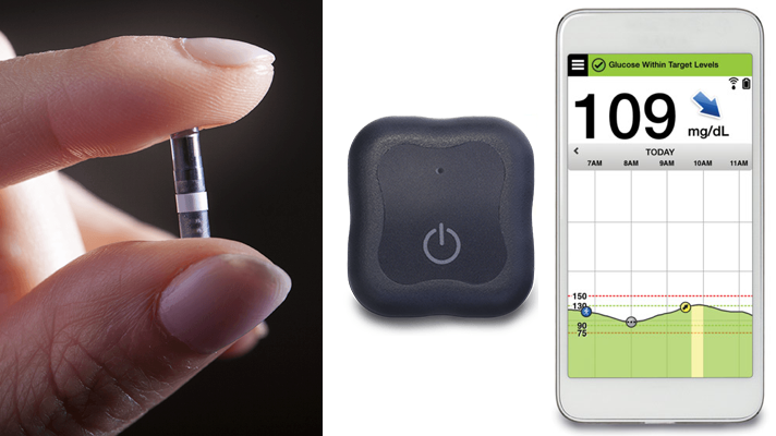 Eversense CGM – Dispositivo implantable que controla la diabetes 6 meses