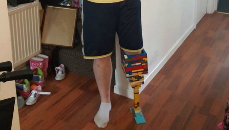 Joven fabrica una ‘pierna de Lego’ para concientizar sobre la diabetes