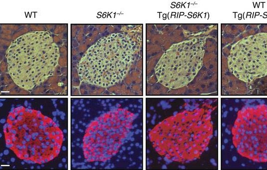La proteína S6K1 podría ayudar a tratar la diabetes tipo 2