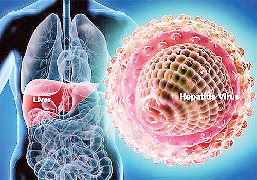 La hepatitis C predispone a la diabetes tipo 2