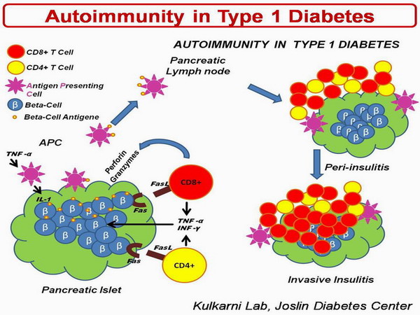 Célula TCD4, implicada en la diabetes tipo 1