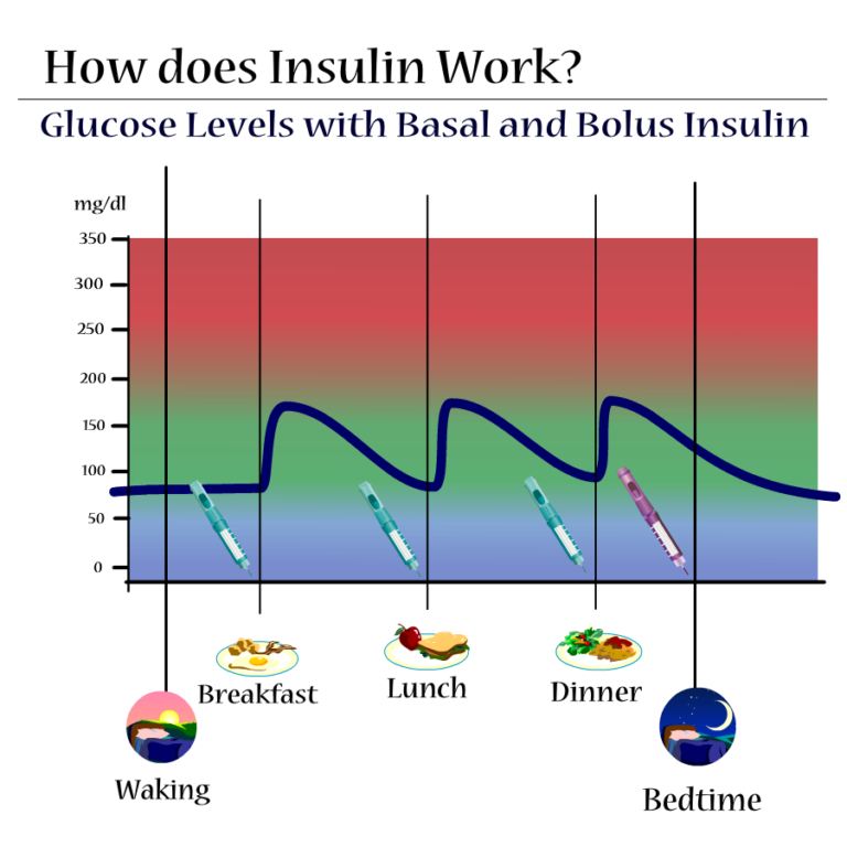 Insulina basal