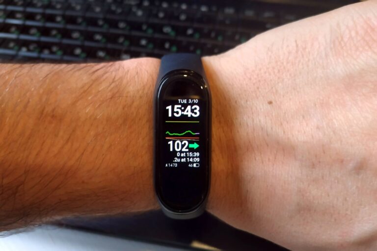 Me recomendais un smartwatch o una pulsera compatible con iPhone y Diabox ?