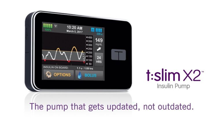 Review + Microinfusora Tandem T:Slim X2 Basal IQ (parada predictiva)