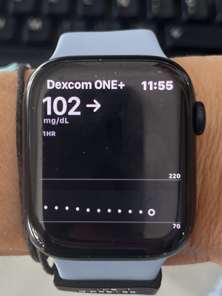 Ayuda con Dexcom one + en el apple watch