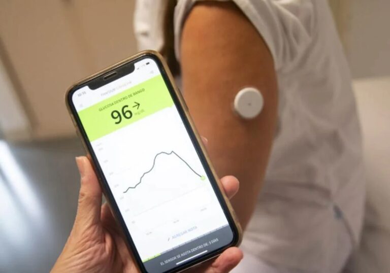 «El sensor de glucosa hace que la diabetes esté mas visibilizada»