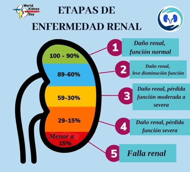 ¿Cómo afecta la enfermedad renal crónica (ERC) a personas con diabetes tipo 2?